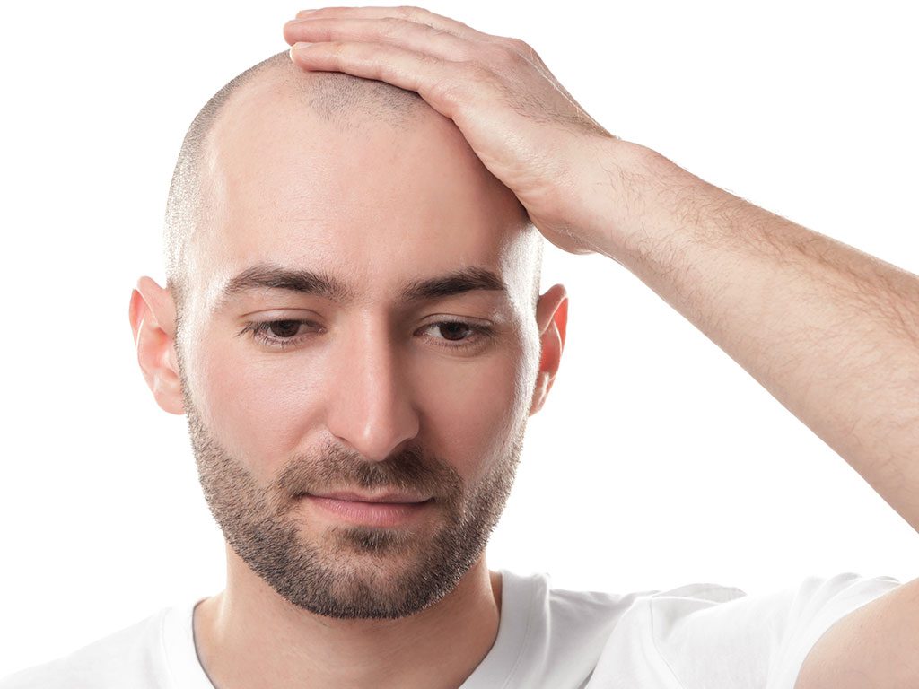 Saç Dökülmesinin Psikolojik Zararları